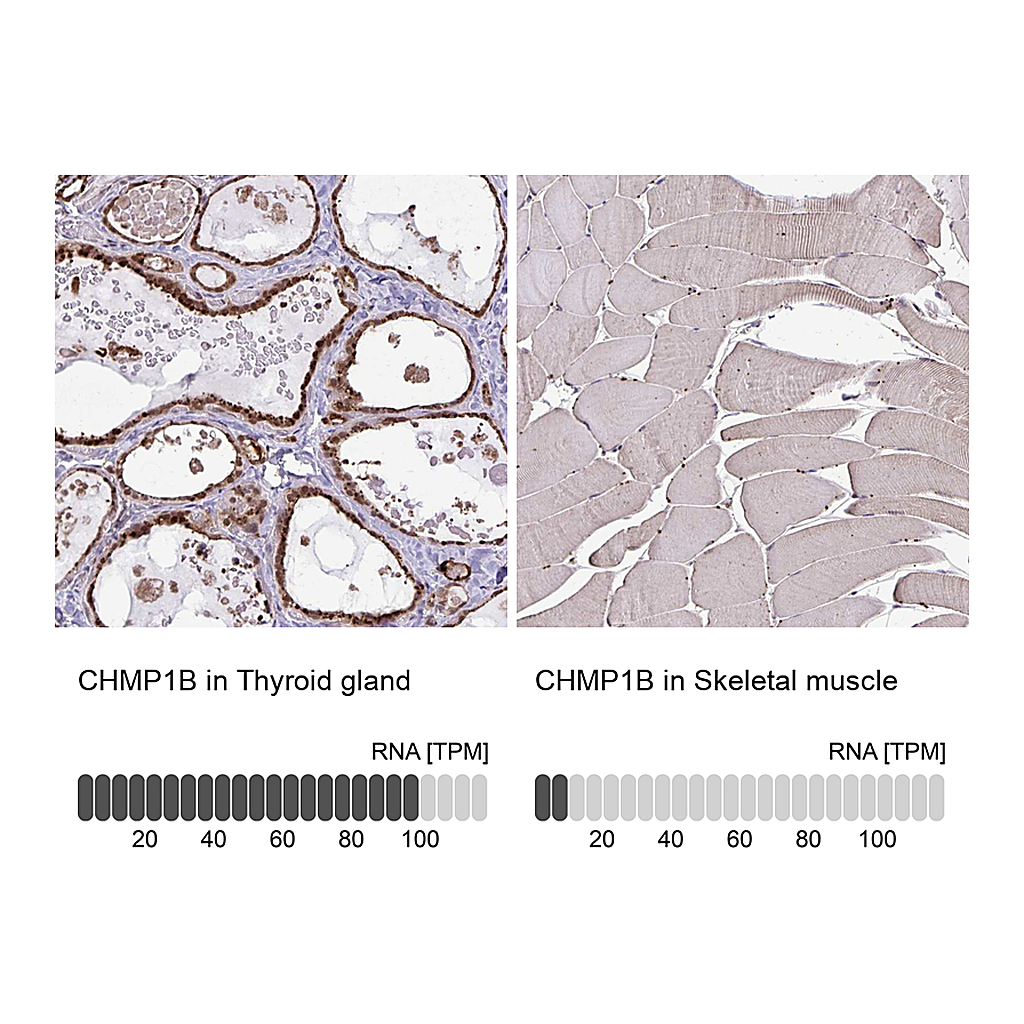 Atlas Antibodies Anti-CHMP1B Antibody