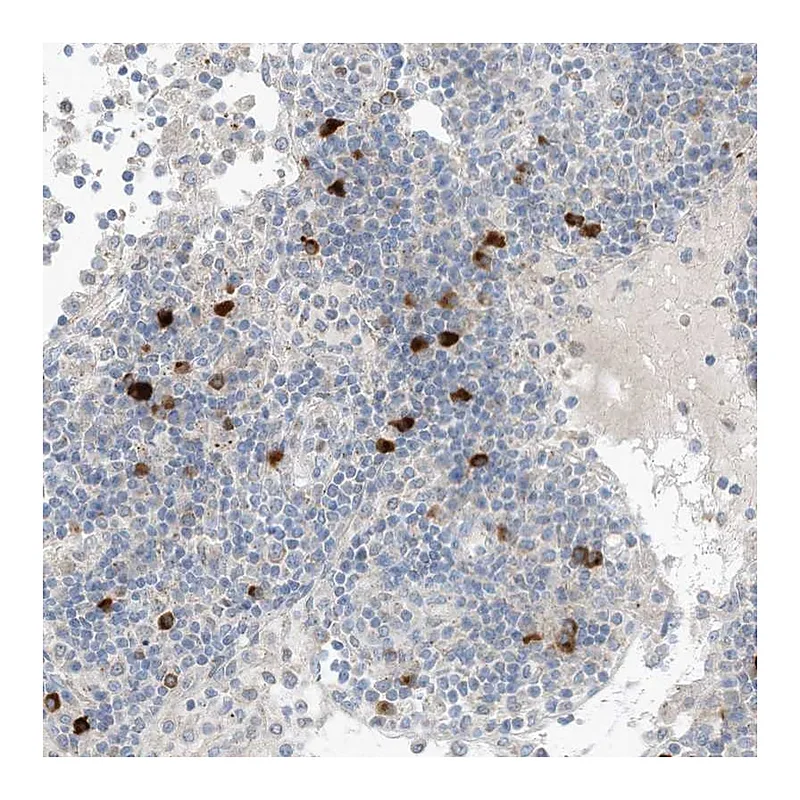 Atlas Antibodies Anti-CHMP2B Antibody