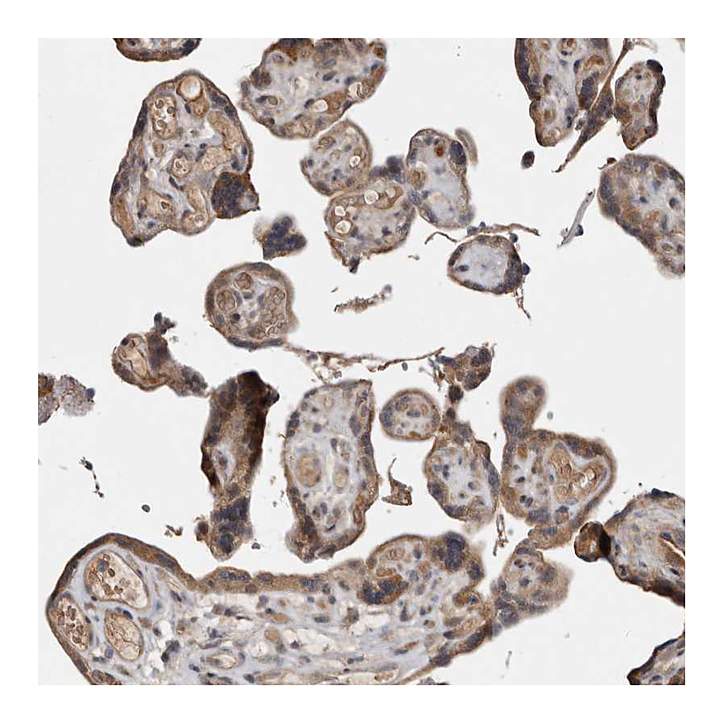 Atlas Antibodies Anti-CHML Antibody
