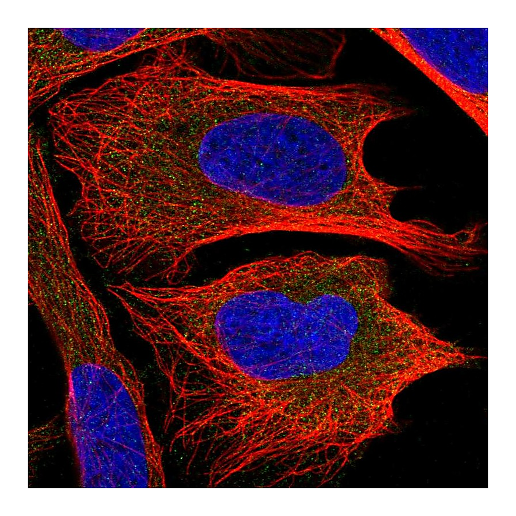 Atlas Antibodies Anti-CHMP2B Antibody
