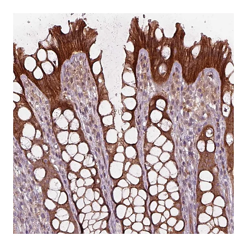 Atlas Antibodies Anti-CHMP3 Antibody