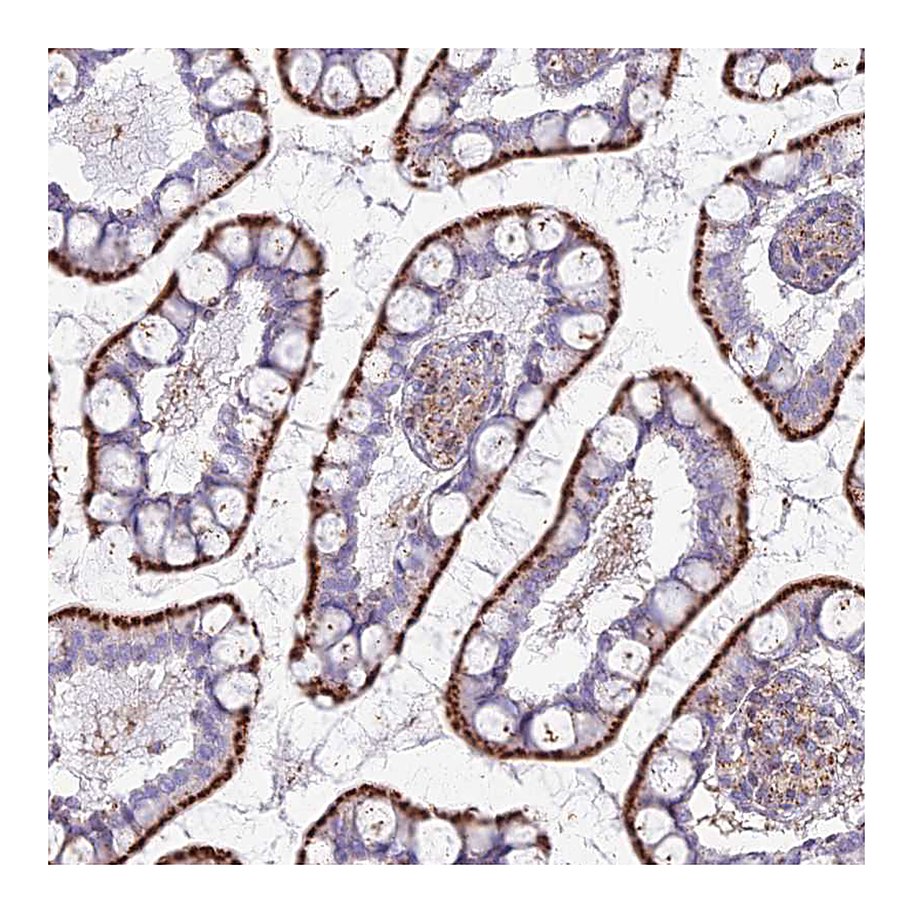 Atlas Antibodies Anti-CHMP4B Antibody