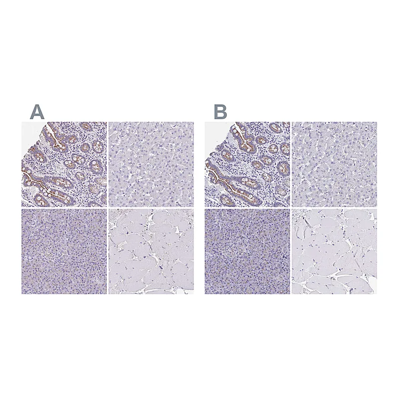 Atlas Antibodies Anti-CHMP5 Antibody