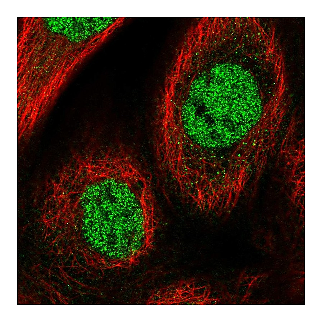 Atlas Antibodies Anti-CHRAC1 Antibody
