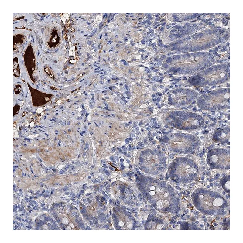 Atlas Antibodies Anti-CHRD Antibody