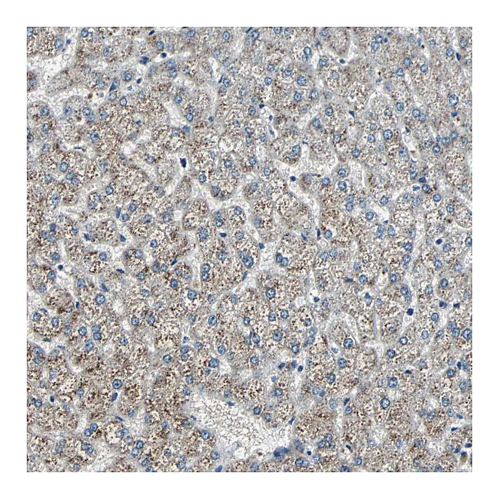 Atlas Antibodies Anti-CHP1 Antibody