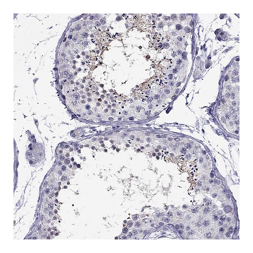 Atlas Antibodies Anti-CHRNB3 Antibody