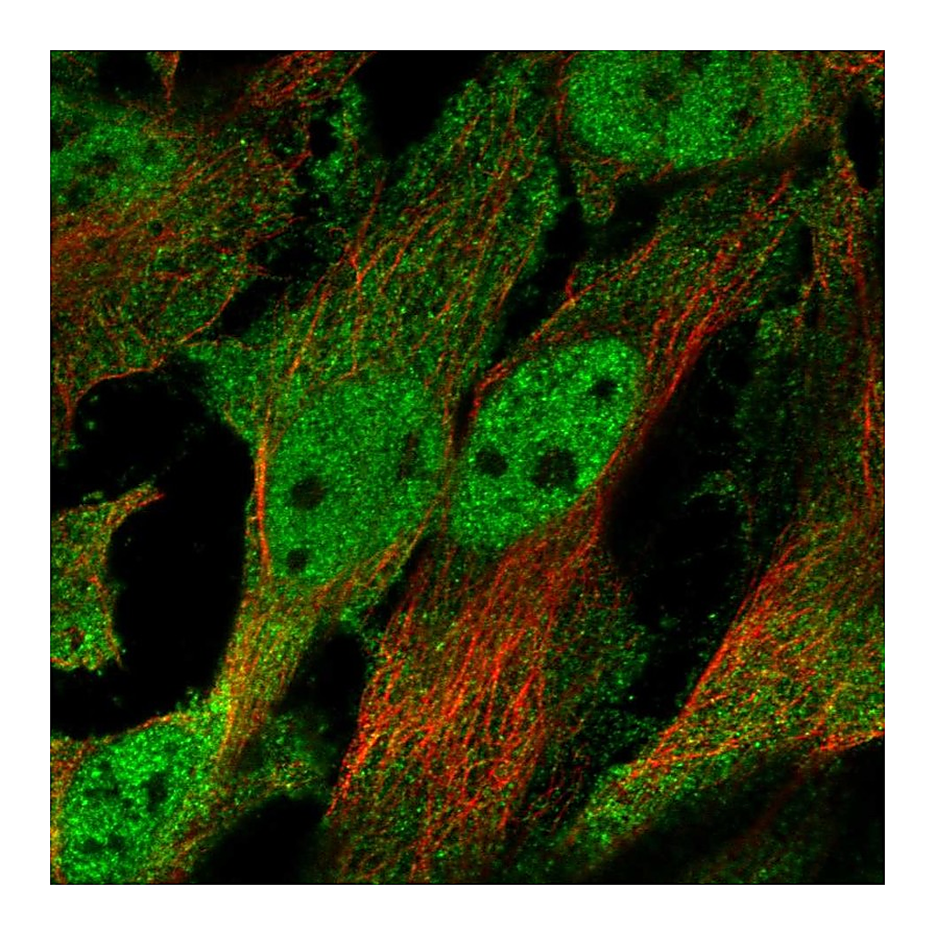 Atlas Antibodies Anti-CHRND Antibody
