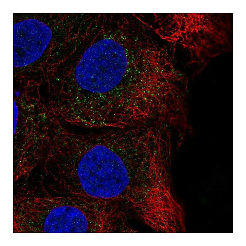 Atlas Antibodies Anti-CHST14 Antibody