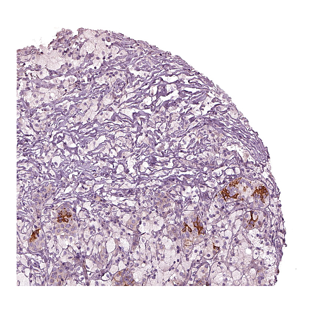 Atlas Antibodies Anti-CHST14 Antibody