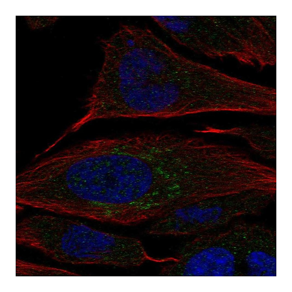 Atlas Antibodies Anti-CHST2 Antibody