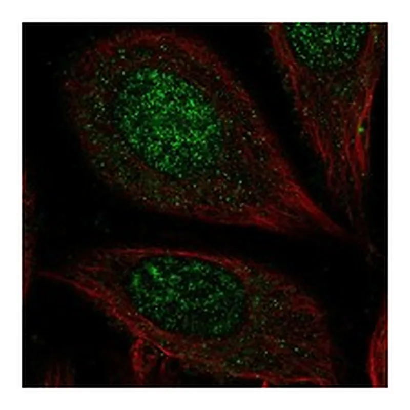 Atlas Antibodies Anti-CHST7 Antibody
