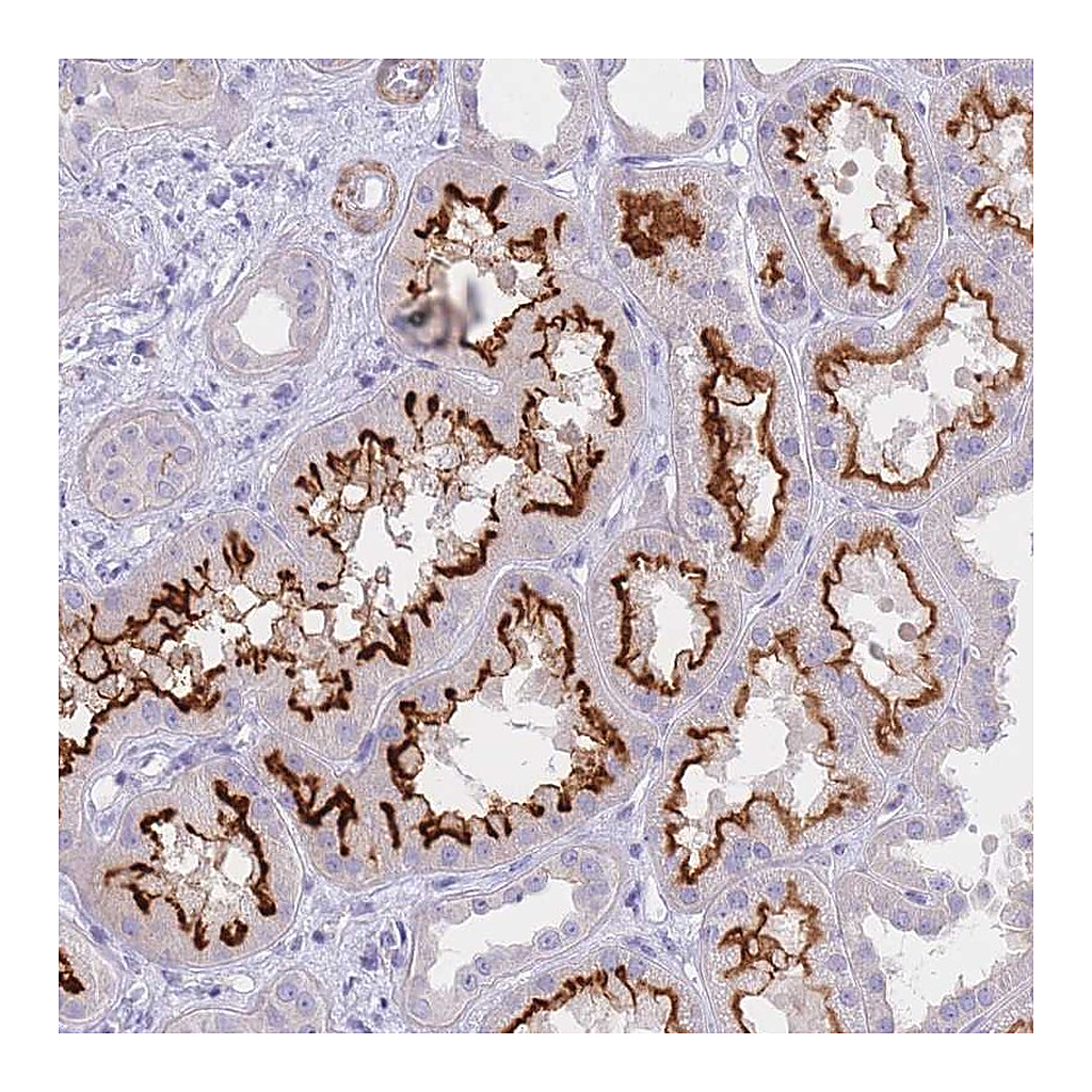 Atlas Antibodies Anti-CHSY1 Antibody