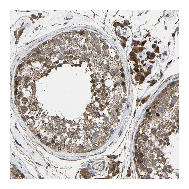 Atlas Antibodies Anti-CHST9 Antibody