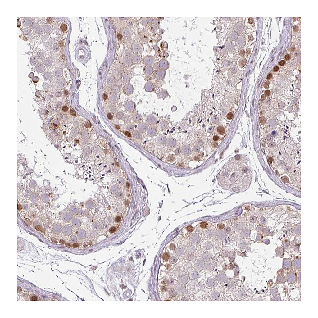 Atlas Antibodies Anti-CHTF8 Antibody