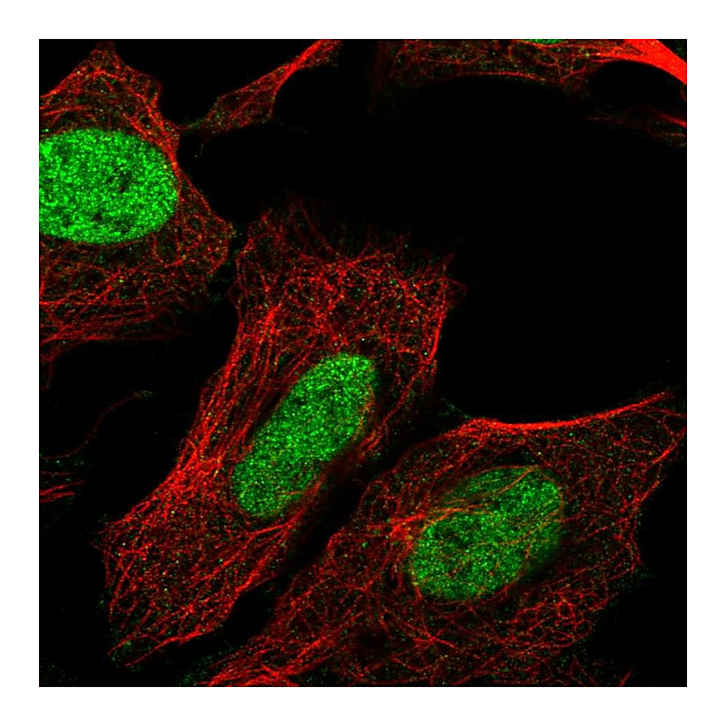 Atlas Antibodies Anti-CHTF8 Antibody