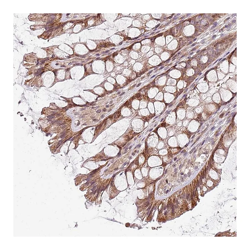 Atlas Antibodies Anti-CHURC1 Antibody