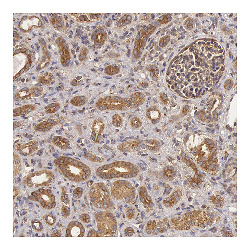 Atlas Antibodies Anti-CHUK Antibody