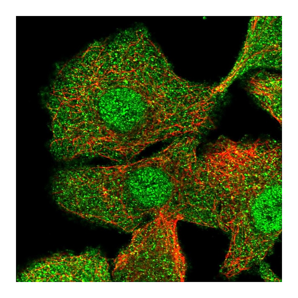 Atlas Antibodies Anti-CIB1 Antibody