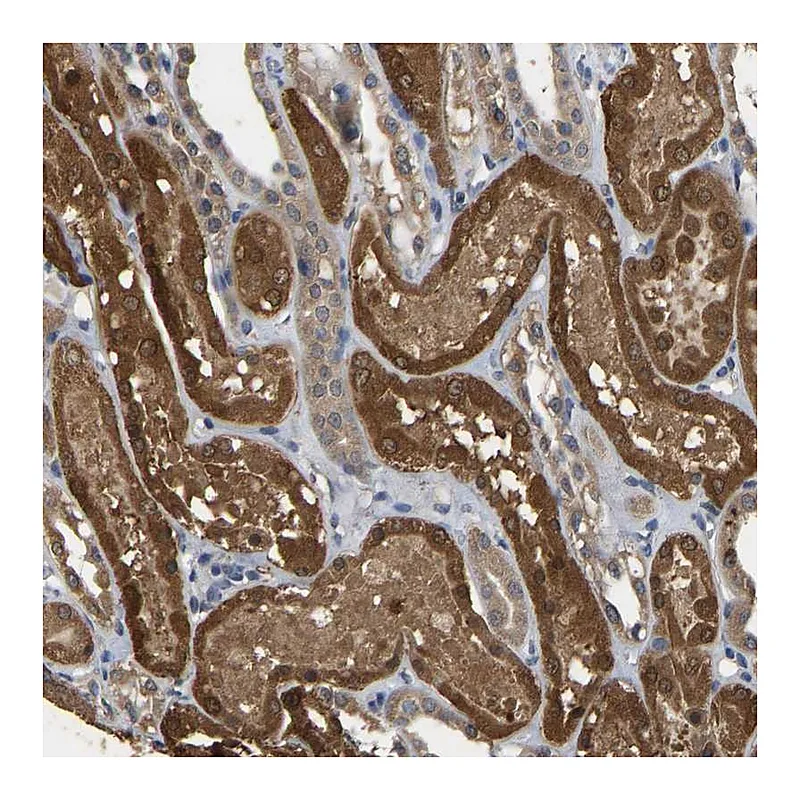 Atlas Antibodies Anti-CIDEC Antibody