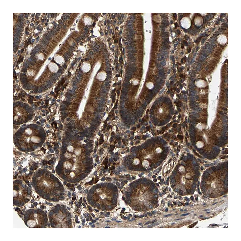 Atlas Antibodies Anti-CIDEC Antibody