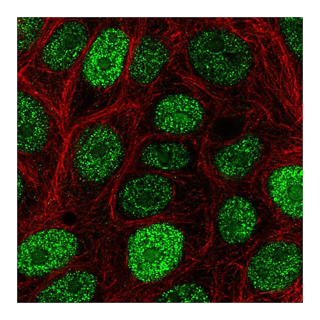 Atlas Antibodies Anti-CIRBP Antibody
