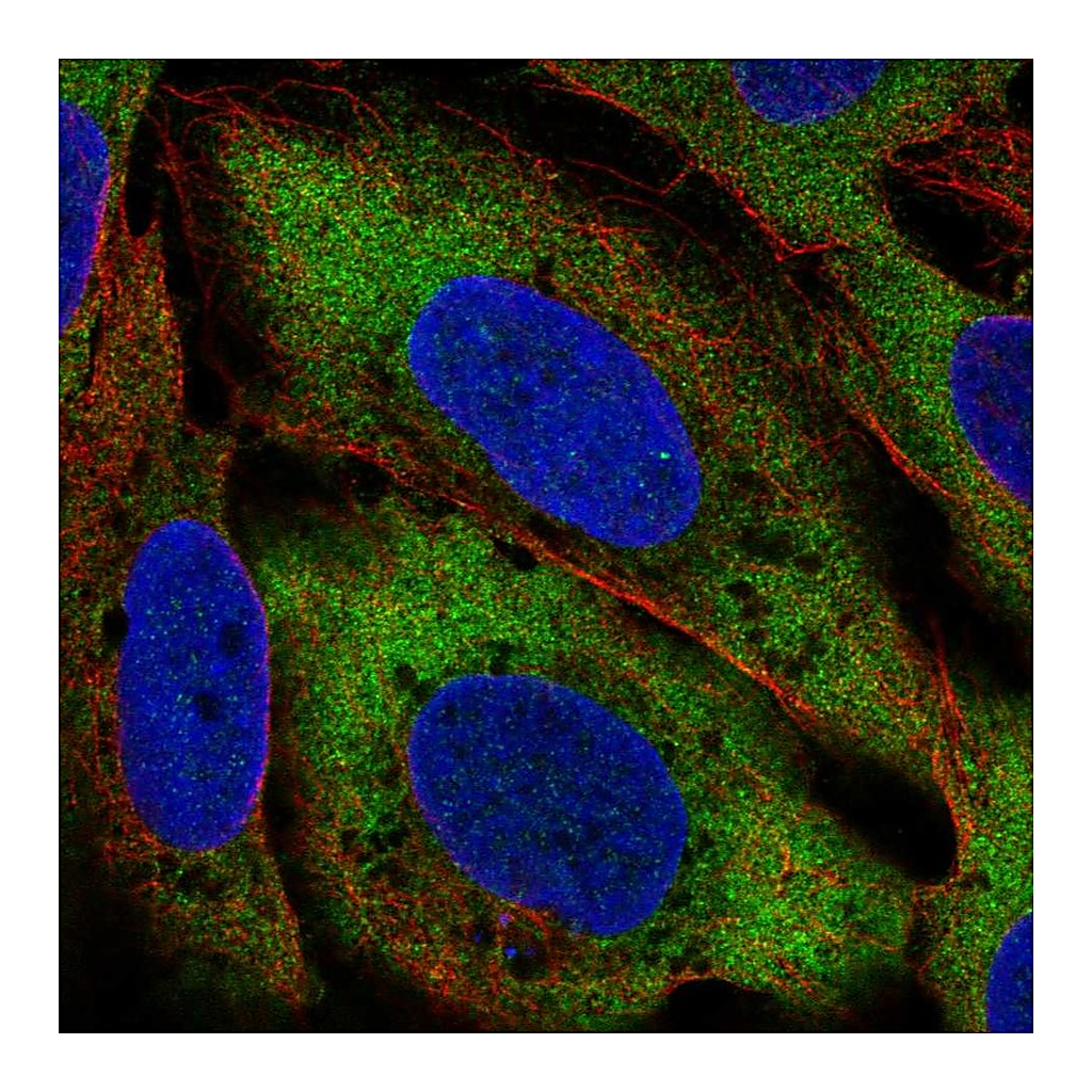 Atlas Antibodies Anti-CIT Antibody
