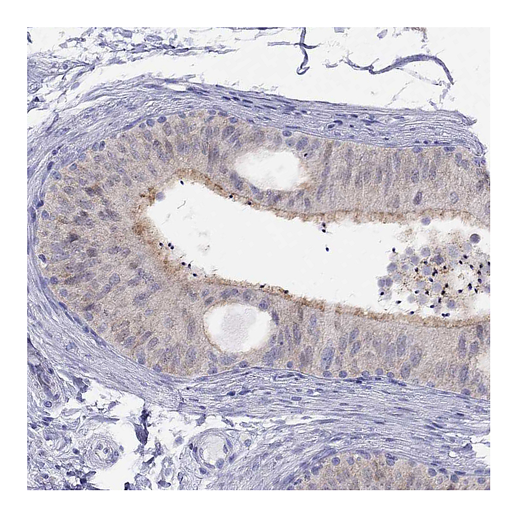 Atlas Antibodies Anti-CITED1 Antibody