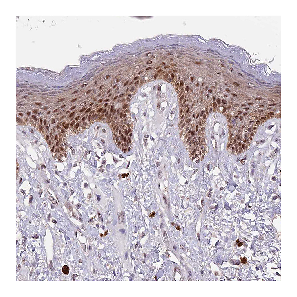 Atlas Antibodies Anti-CIZ1 Antibody