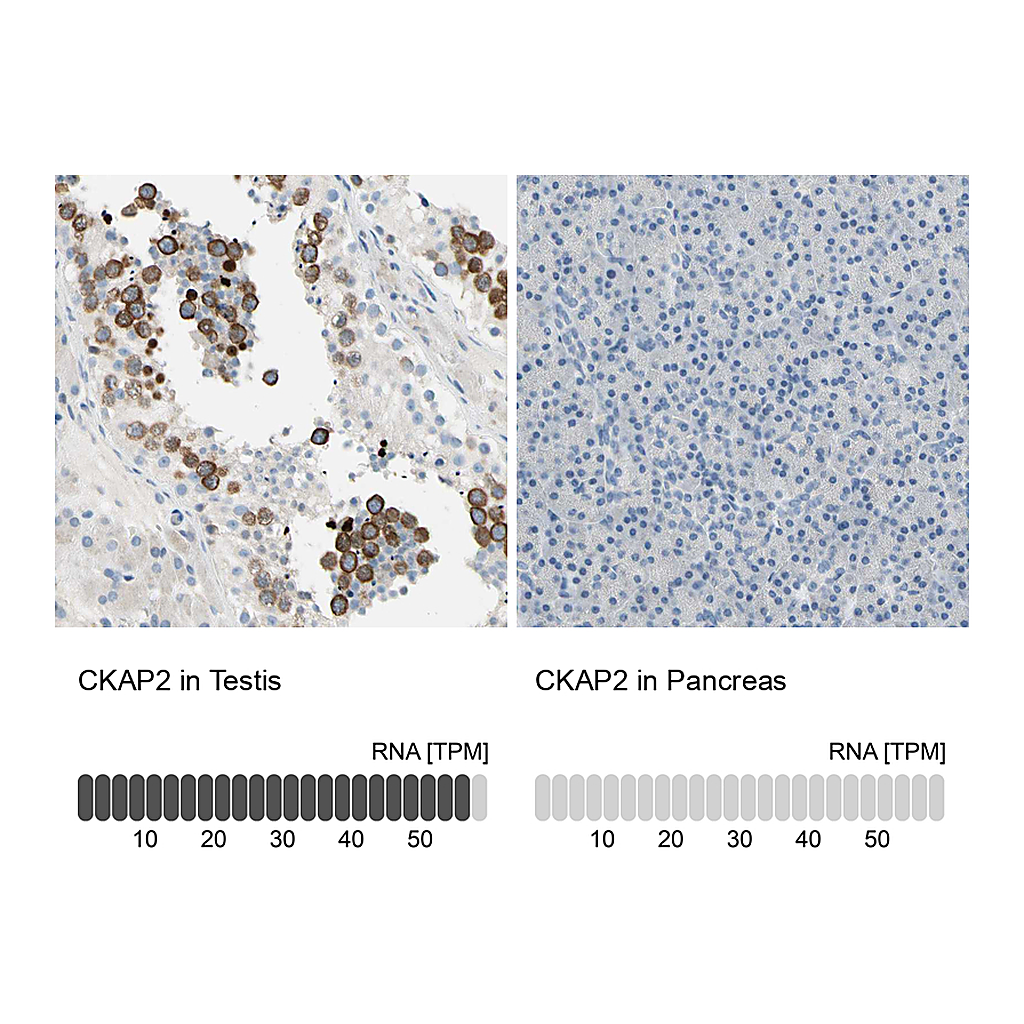 Atlas Antibodies Anti-CKAP2 Antibody