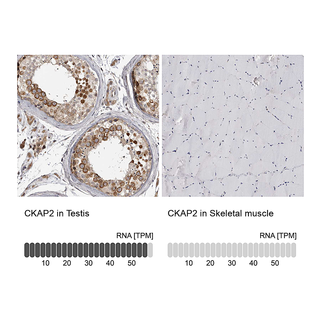 Atlas Antibodies Anti-CKAP2 Antibody