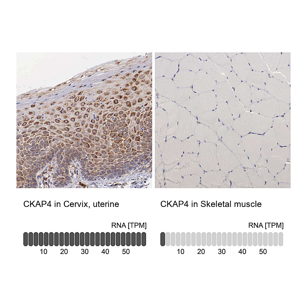 Atlas Antibodies Anti-CKAP4 Antibody