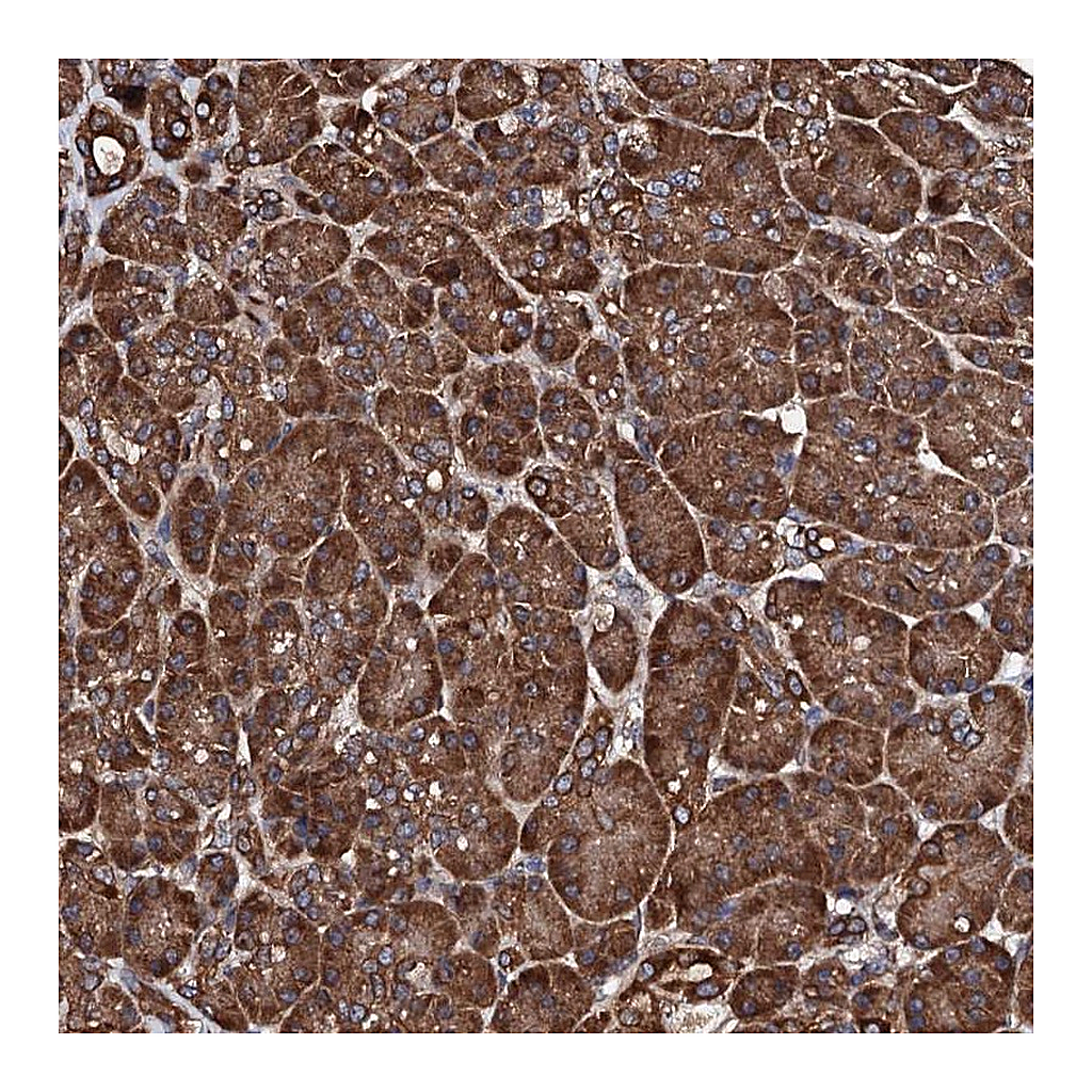 Atlas Antibodies Anti-CKAP5 Antibody