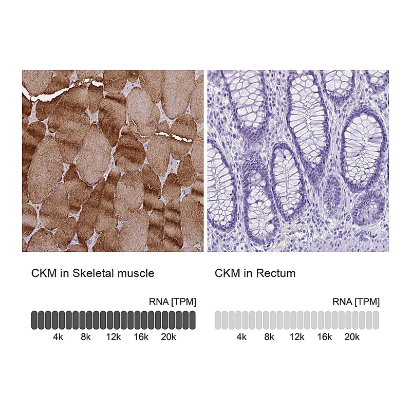 Atlas Antibodies Anti-CKM Antibody