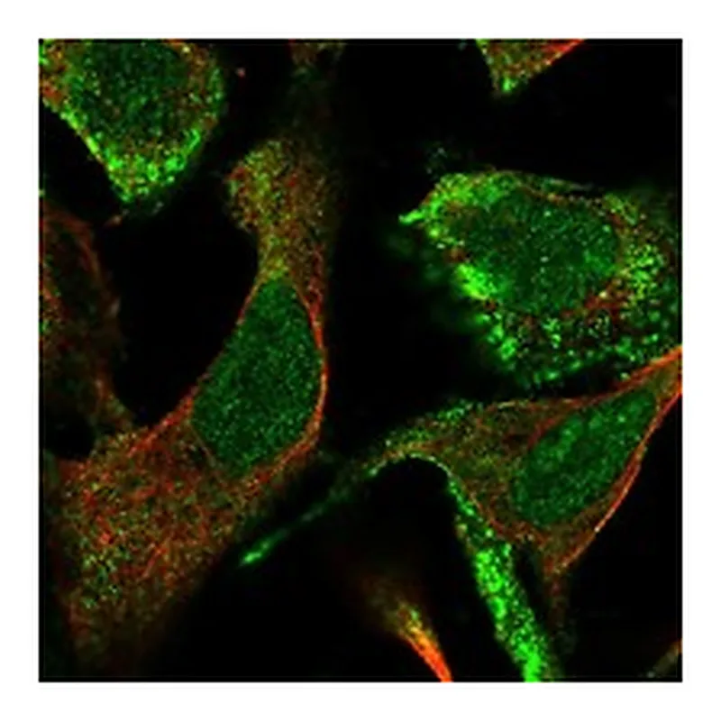 Atlas Antibodies Anti-CLCA4 Antibody