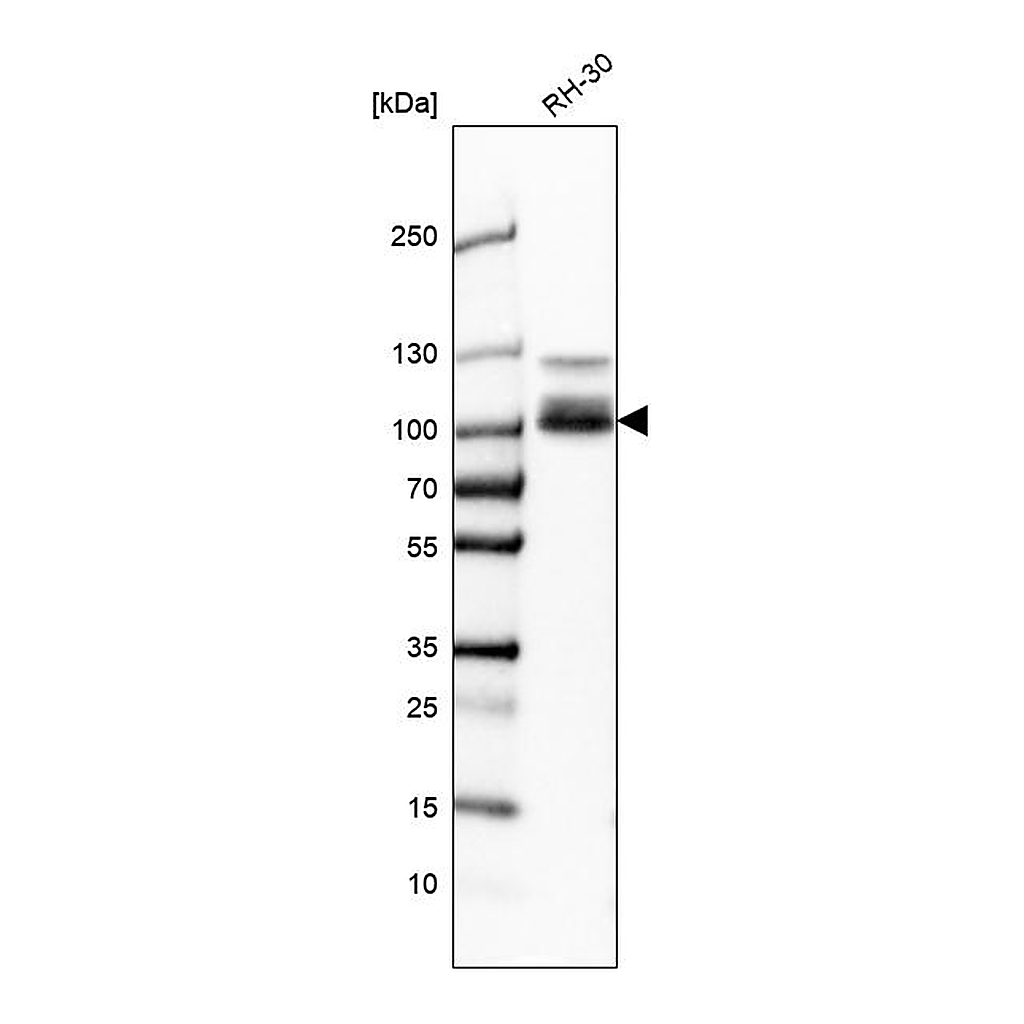 Atlas Antibodies Anti-CLCN5 Antibody