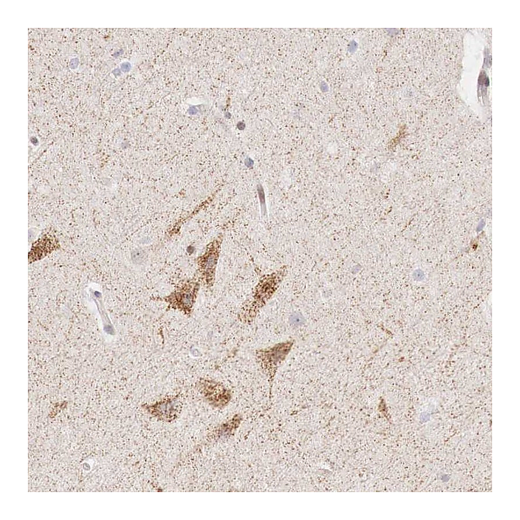 Atlas Antibodies Anti-CLCN5 Antibody