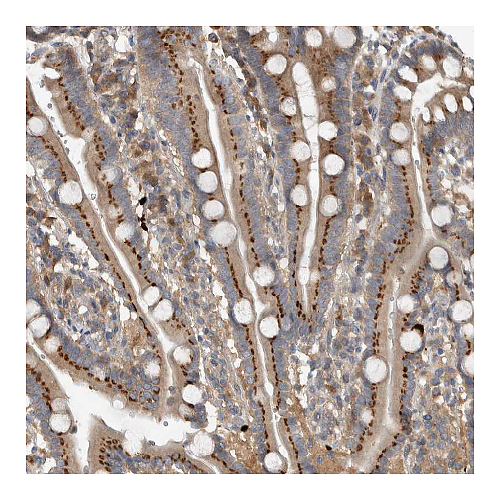 Atlas Antibodies Anti-CLCN2 Antibody