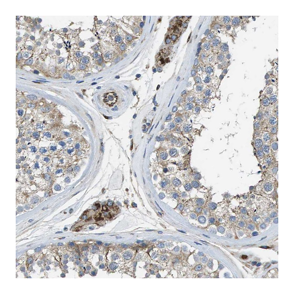 Atlas Antibodies Anti-CLCN2 Antibody