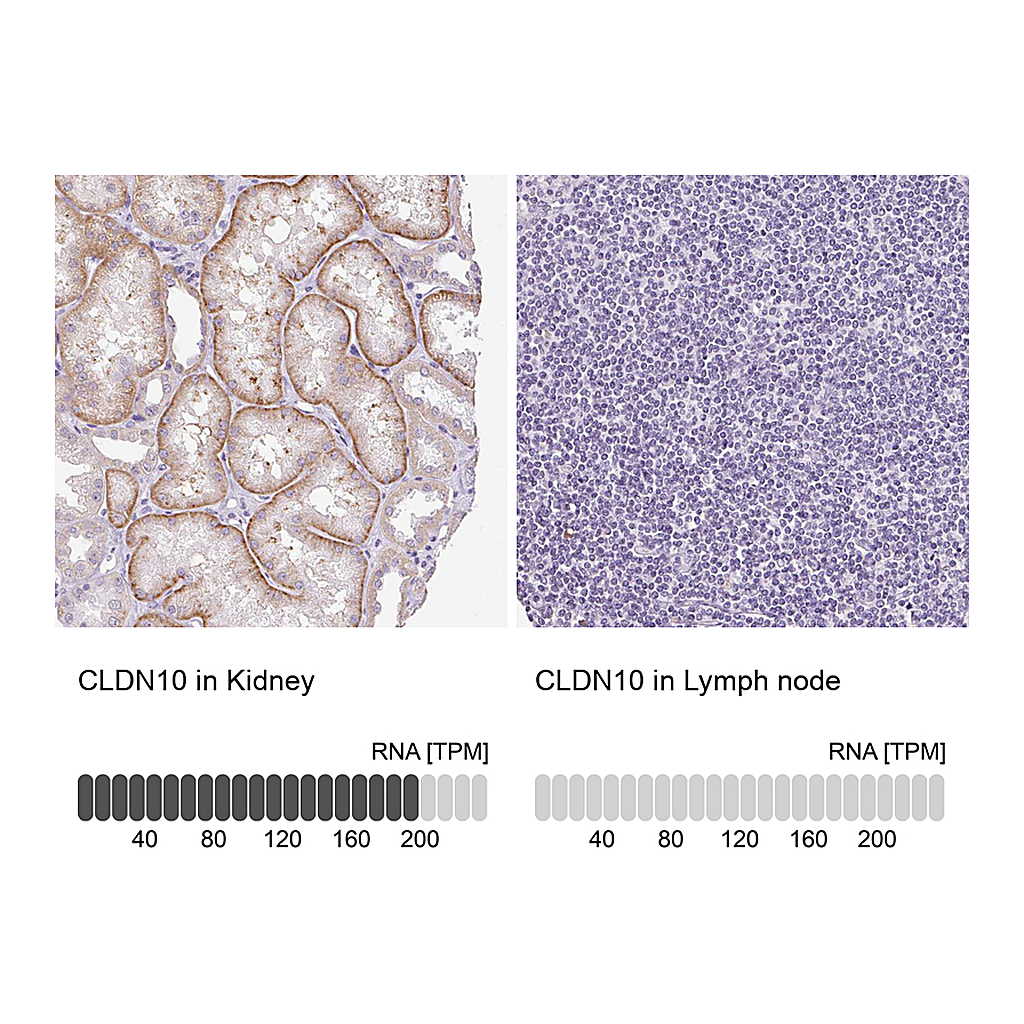 Atlas Antibodies Anti-CLDN10 Antibody