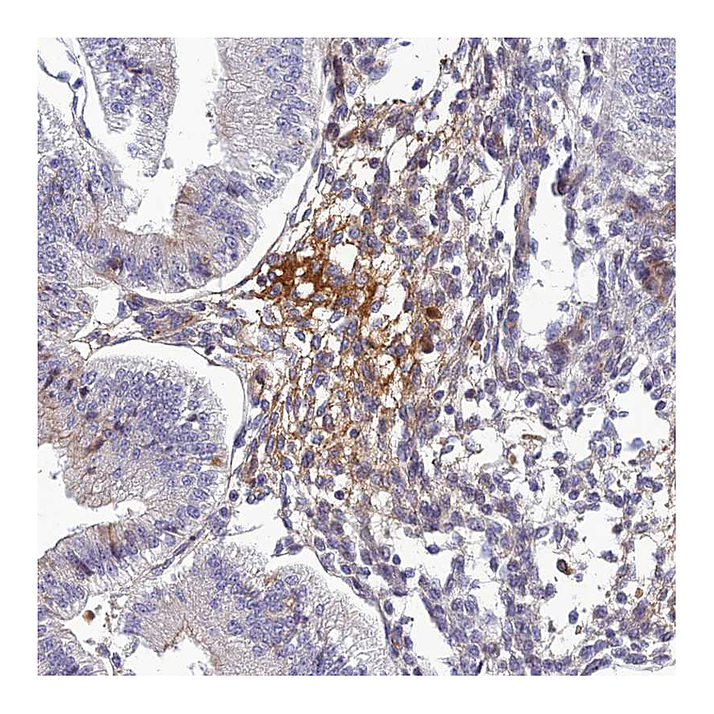 Atlas Antibodies Anti-CLEC11A Antibody