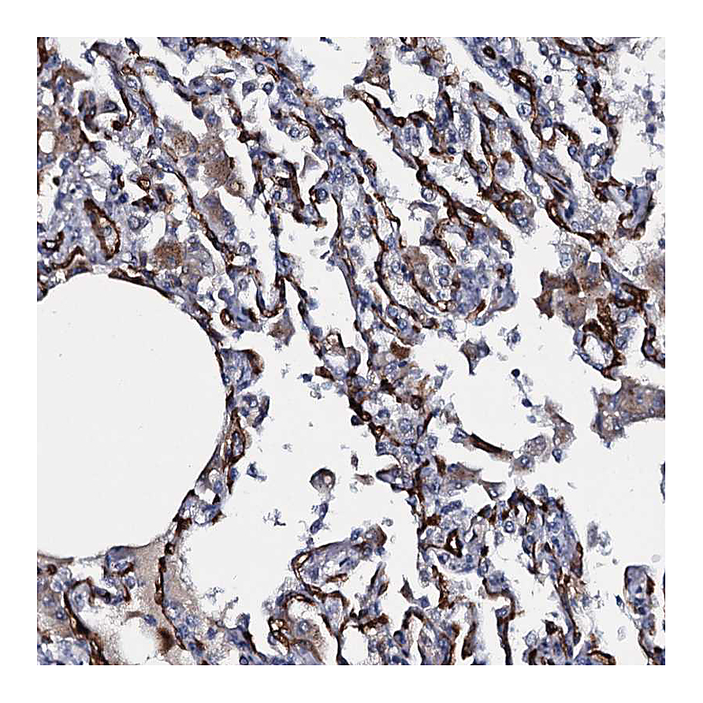 Atlas Antibodies Anti-CLEC14A Antibody
