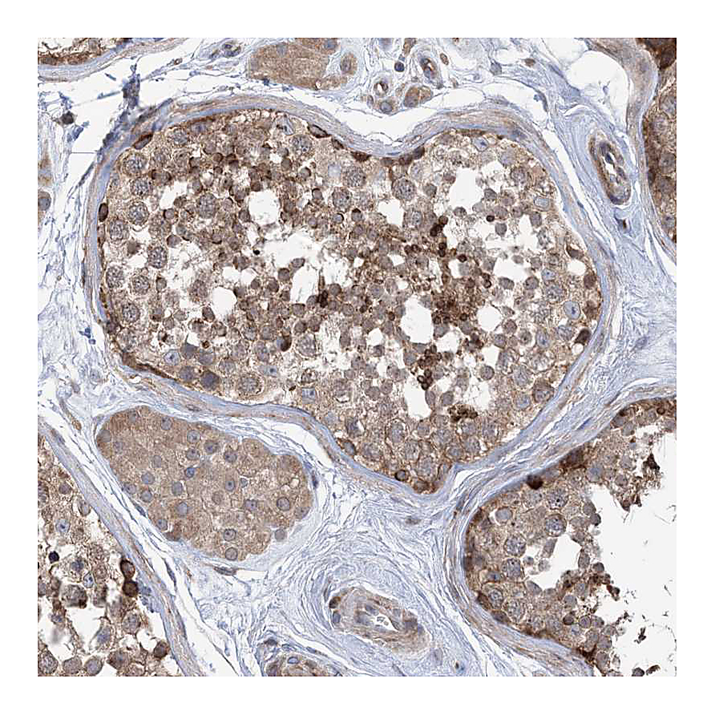 Atlas Antibodies Anti-CLEC16A Antibody