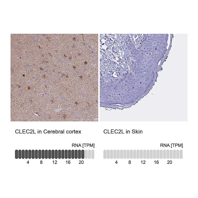 Atlas Antibodies Anti-CLEC2L Antibody