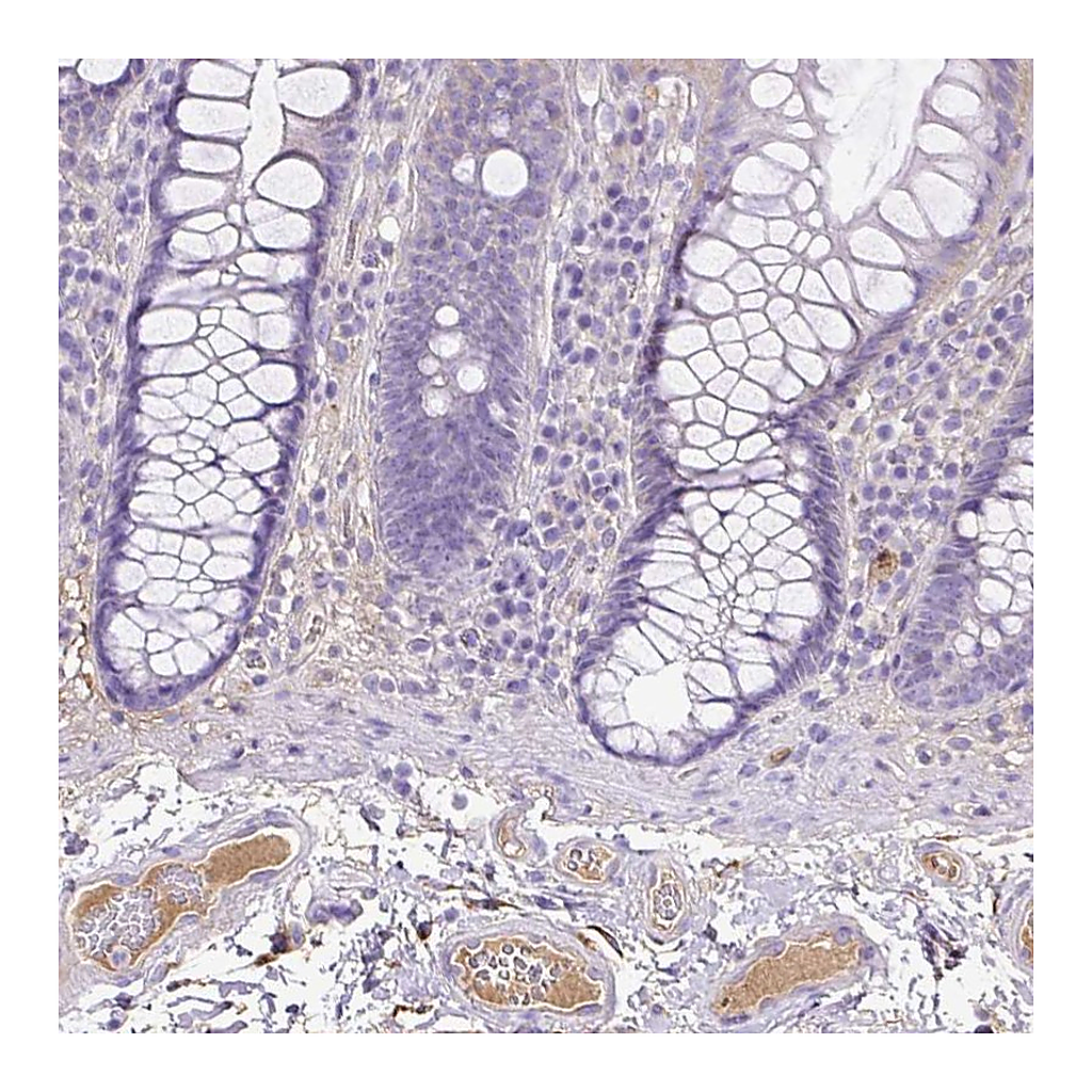 Atlas Antibodies Anti-CLEC3B Antibody