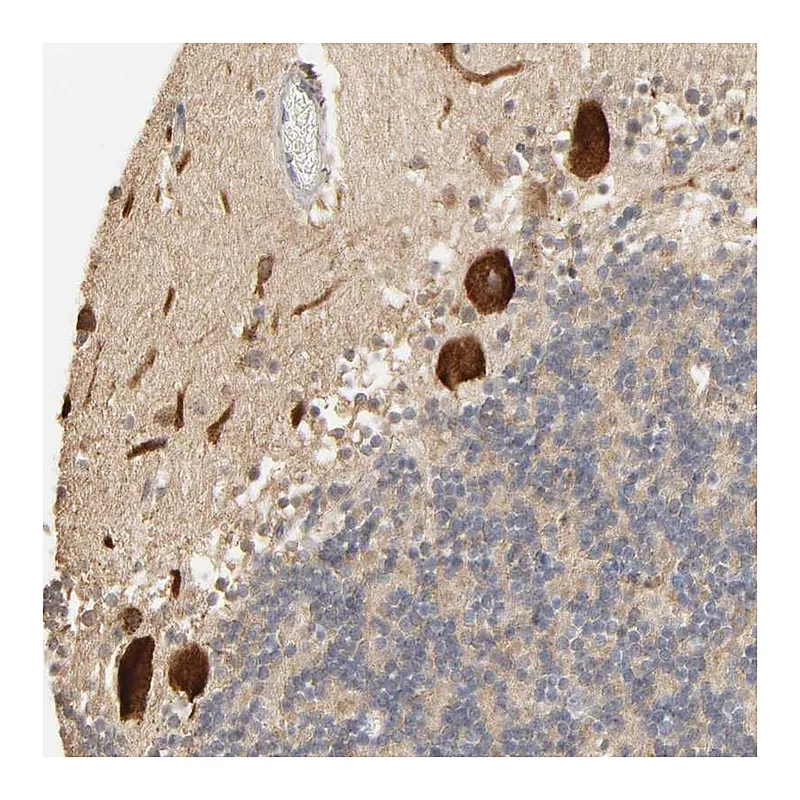 Atlas Antibodies Anti-CLEC4E Antibody