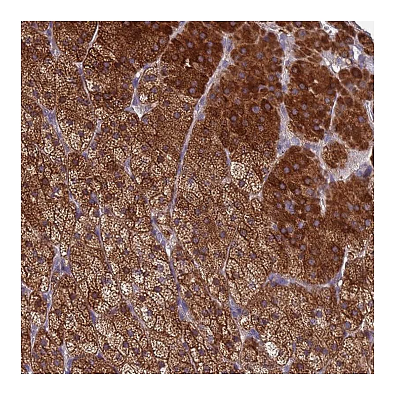 Atlas Antibodies Anti-CLHC1 Antibody
