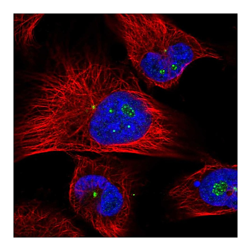 Atlas Antibodies Anti-CLHC1 Antibody