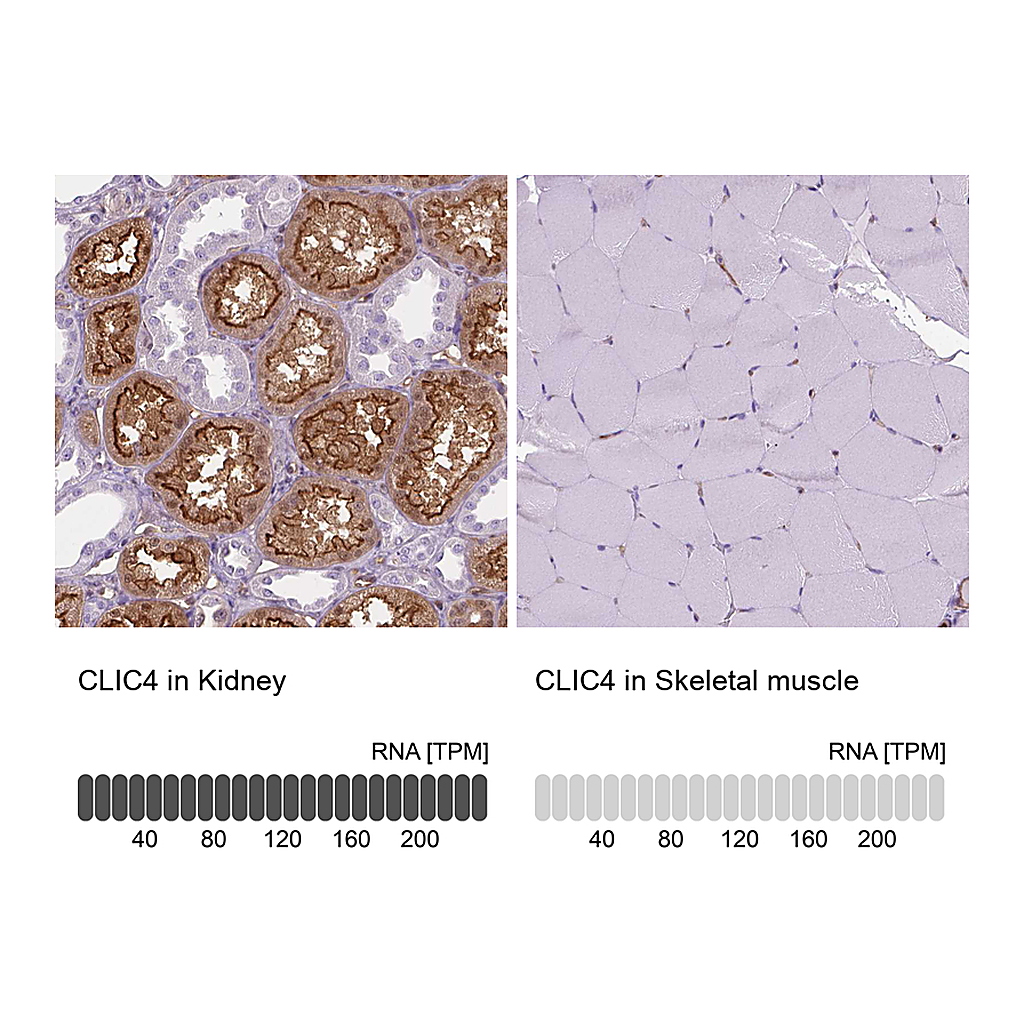 Atlas Antibodies Anti-CLIC4 Antibody