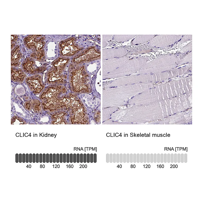 Atlas Antibodies Anti-CLIC4 Antibody